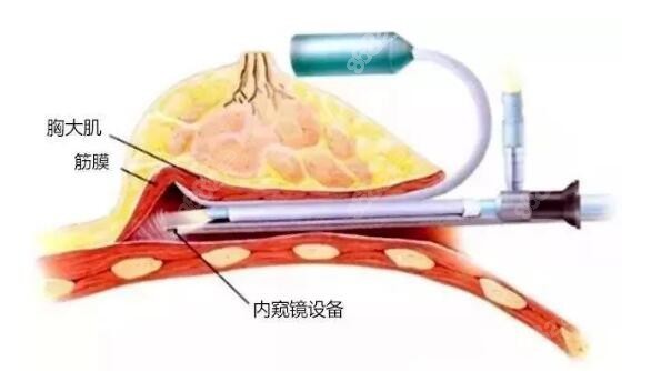 广州美恩整形医院收费价格表