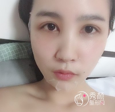 上海华美杨亚益割双眼皮开眼角恢复过程，7mm扇形真的很适合我！