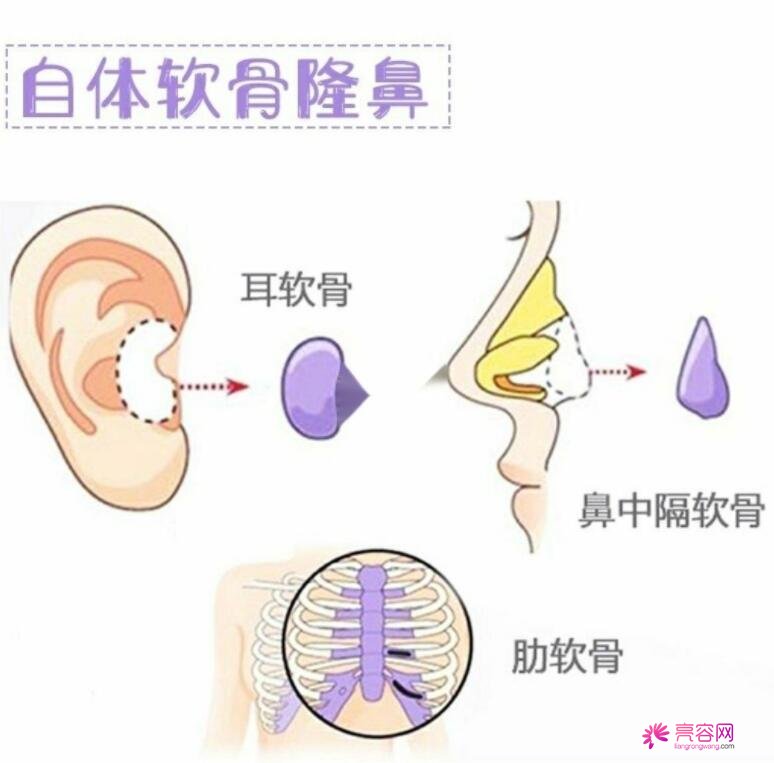 济南爱容整形医院靠谱吗？整形医生信息+隆鼻案例了解这些你就知道了