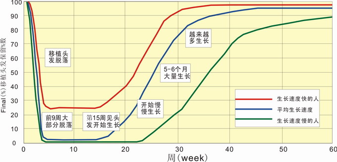 比较好的植发的方法有哪些