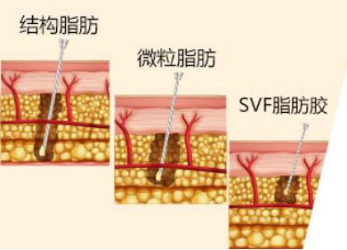 哈尔滨欧兰仁美医院：全面部填充一次体验 即可定格面部美丽